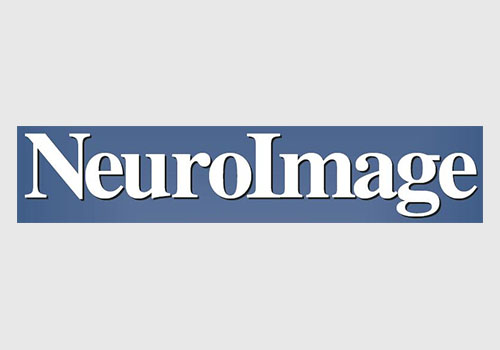Fast and robust multi-atlas segmentation of brain magnetic resonance images