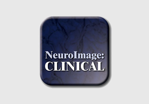 Detecting frontotemporal dementia syndromes using MRI biomarkers
