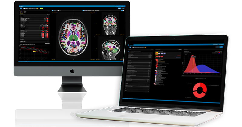Read more about the article cNeuro 2.0