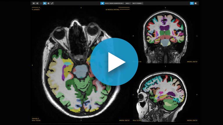 Read more about the article Data-driven diagnostics webinar landing page