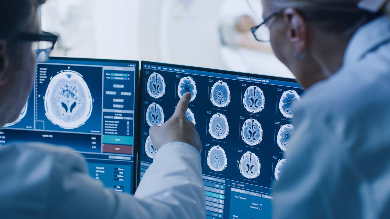 Read more about the article Slicing through the fog of neurodegeneration with cutting-edge tools: feedback from ASNR22